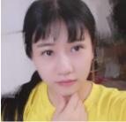 嘉兴曙光医院王艳双眼皮开得好?附王艳医生双眼皮案例效果图及价格