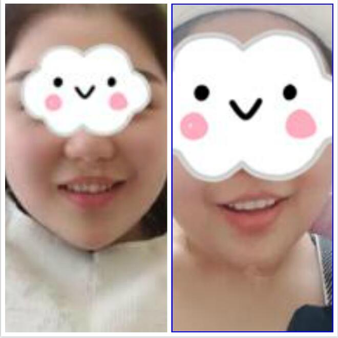 上海九院口腔科整形美容价格附口腔科专家案例_出诊时间_挂号攻略