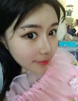 广州美莱罗延平做的鼻子如何?罗延平鼻整形技术_审美风格_案例效果价格