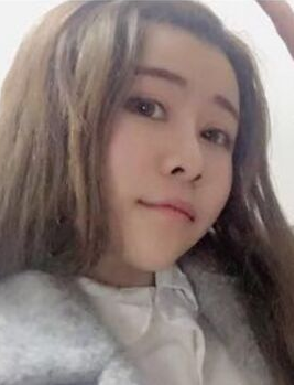 广州美莱罗延平做的鼻子如何?罗延平鼻整形技术_审美风格_案例效果价格