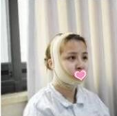 湖北武汉有做磨骨手术的医院吗?我颧骨宽/下颌角突出想通过磨骨手术瘦脸