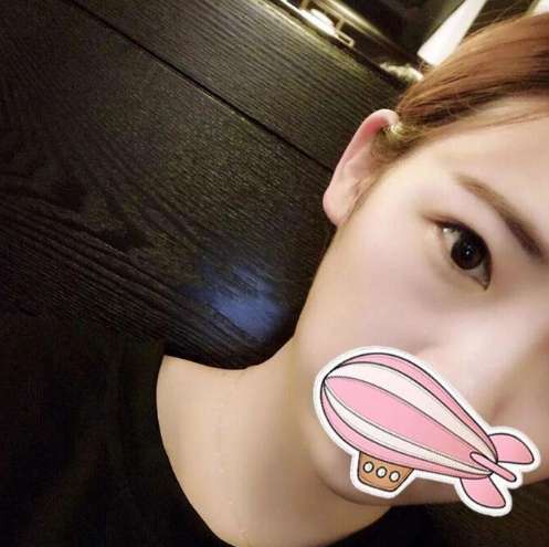 杭州黛雅周君芳双眼皮整形怎么样?会失败吗?周君芳案例效果_口碑评价_预约方式