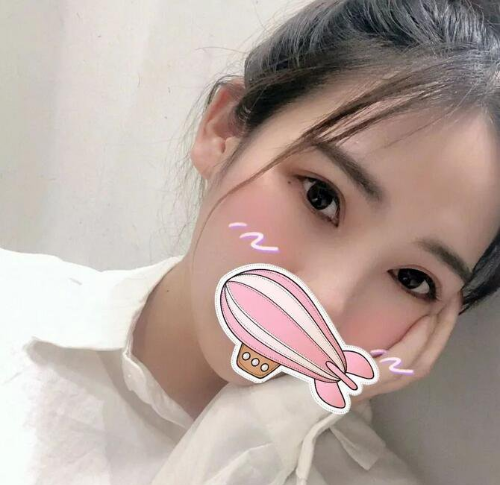 杭州黛雅周君芳双眼皮整形怎么样?会失败吗?周君芳案例效果_口碑评价_预约方式