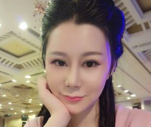 杭州维多利亚刘中策做鼻子怎么样?会失败吗?刘中策鼻整形案例效果图及价格