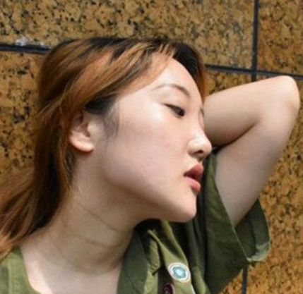 上海九院韦敏怎么预约?想挂上海九院韦敏医生的号做下颌角磨骨手术