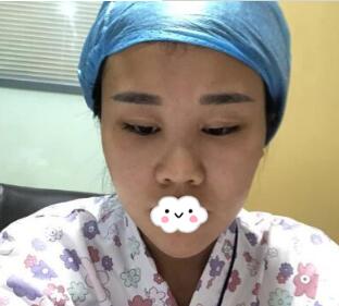 上海华美张朋隆鼻好吗?我想做那种别人看不出来是做的鼻子
