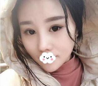 上海华美张朋隆鼻好吗?我想做那种别人看不出来是做的鼻子
