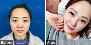 上海九院戴传昌技术怎么样?戴传昌简介_门诊时间_擅长风格_案例效果_价格
