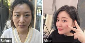 上海九院戴传昌技术怎么样?戴传昌简介_门诊时间_擅长风格_案例效果_价格