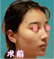 怎么联系北京协和医生王阳?王阳在哪些医院坐诊?