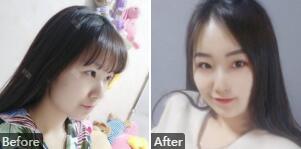 北京八大处磨腮谁做的好_八大处磨骨专家排行榜及手术价格费用