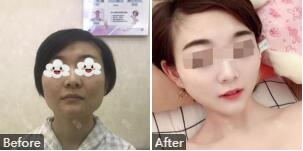 北京八大处颌面整形专家案例效果_手术价格(价目表)_坐诊时间(出诊表)