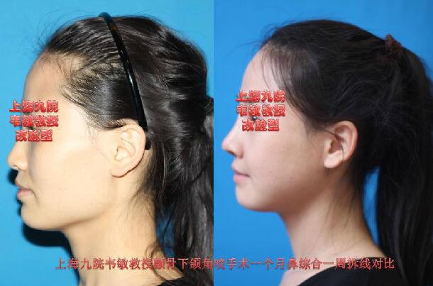 上海九院韦敏是什么科?怎么挂韦敏的号?韦敏门诊时间?手术安排时间?