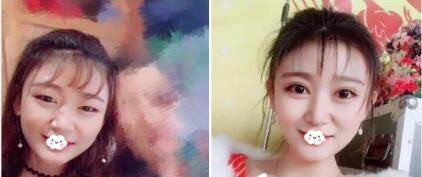 广州广美美莱华美哪个好?医院资质、医生案例、价格综合比较