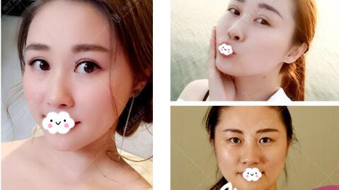 广州广美美莱华美哪个好?医院资质、医生案例、价格综合比较
