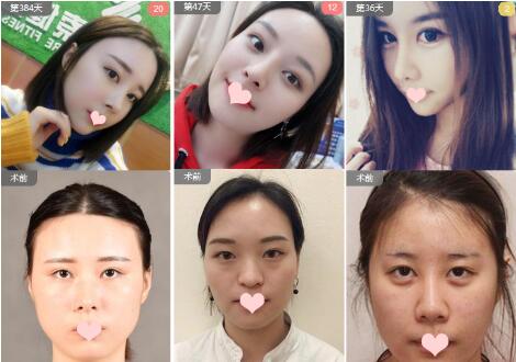 广州广美美莱华美哪个好?医院资质、医生案例、价格综合比较