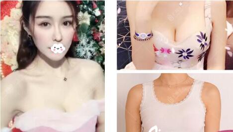 广州广美美莱华美哪个好?医院资质、医生案例、价格综合比较