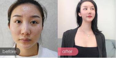 广州广美美莱华美哪个好?医院资质、医生案例、价格综合比较
