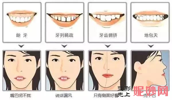 深圳非凡牙齿矫正只需28000元，一口好牙开启招牌月牙笑