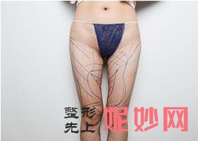 OX型粗短腿这么简单就矫正了?北京艺美王东院长通过腿部外在轮廓的改变实现腿部美丽塑形
