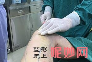 OX型粗短腿这么简单就矫正了?北京艺美王东院长通过腿部外在轮廓的改变实现腿部美丽塑形