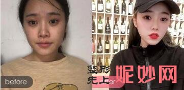 成都做光子嫩肤哪家医院好?成都西区医院、瑞亚凯俪医院做光子嫩肤效果怎样