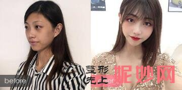 成都做光子嫩肤哪家医院好?成都西区医院、瑞亚凯俪医院做光子嫩肤效果怎样