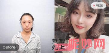 北京华韩医院谢立宁、禾美嘉医院任学会谁抽脂填充手效果好?