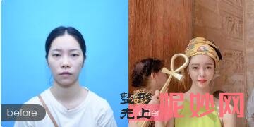 北京禾美嘉、上上相、清木、玉之光、东方和谐、联合丽格擅长脂肪填充出名的医生及案例效果