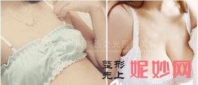 北京**的王明利、朱金成医生谁脂肪填充面部好?谁更厉害?