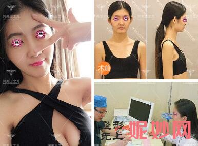 北京**的王明利、朱金成医生谁脂肪填充面部好?谁更厉害?