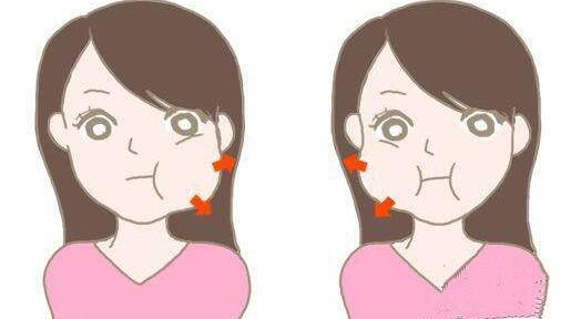 咬肌肥大可以做磨骨手术去除吗?会有什么后遗症