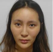 上海九院李青峰隆鼻技术怎么样?附门诊预约时间表