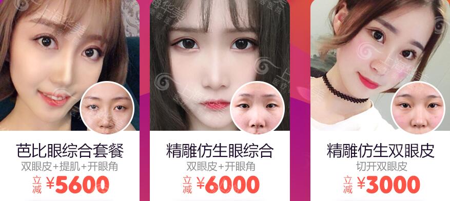 上海华美张朋隐形切开双眼皮效果怎么样?附较新双眼皮手术价格