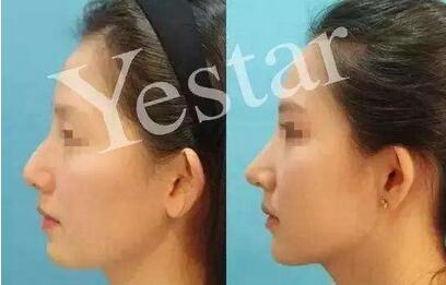 上海艺星整容靠谱吗?上海艺星出名的整形医生有哪些?