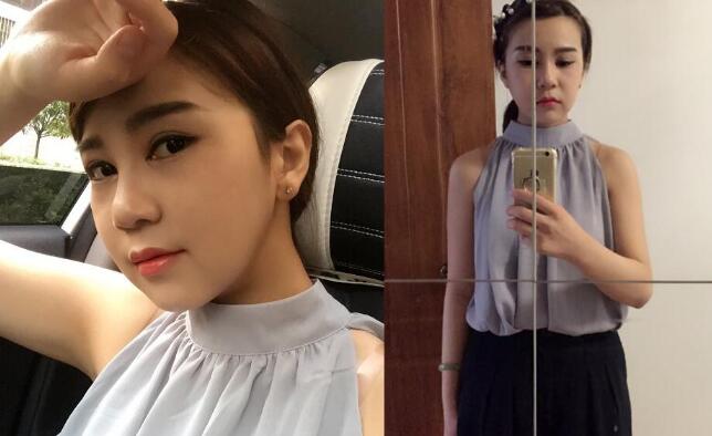 做完磨骨手术后的真实感受