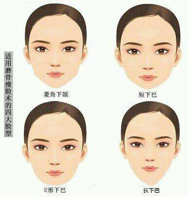 做完磨骨手术后的真实感受