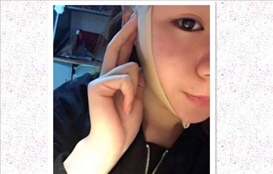 面部吸脂做得比较好的医院有哪些?