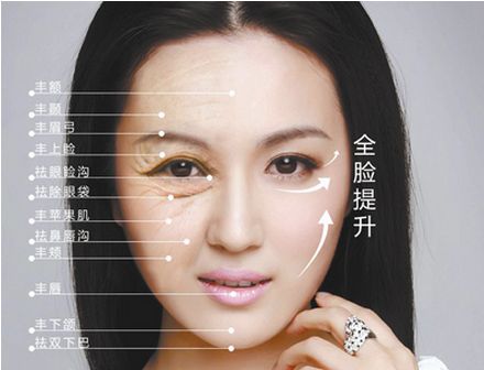 面部年轻化能管多久?
