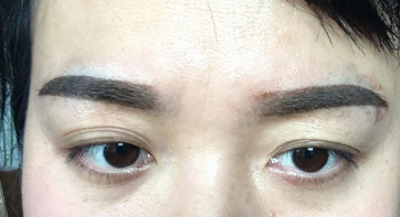 纹眉后恢复自然需要多长时间?
