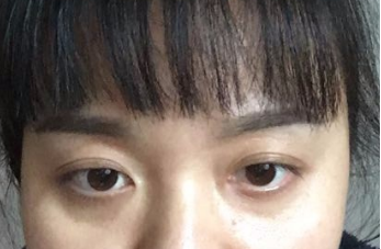 纹眉后恢复自然需要多长时间?