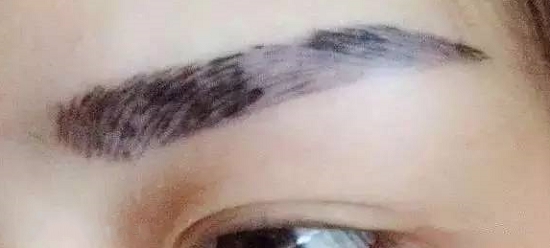 纹眉失败后是很吓人的
