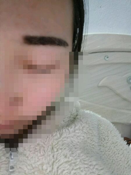 纹眉后多久开始掉痂?