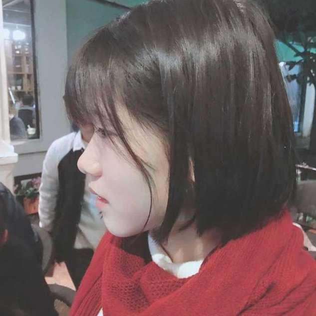 后悔没有早点矫正牙齿 牙齿矫正后的图片