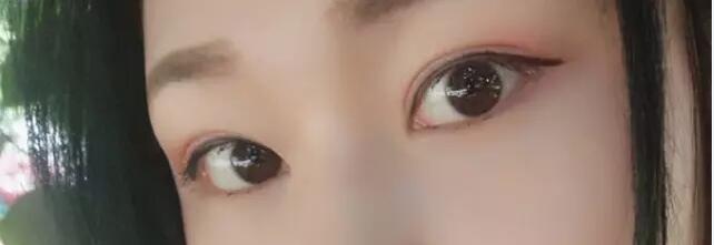 上海浦东新区这家医院割双眼皮既好看又自然