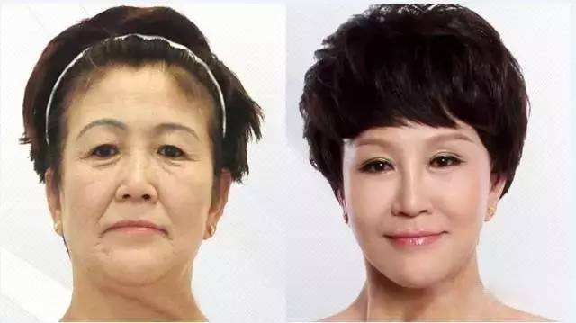 水光*效果怎么样?看她是如何从奶奶逆生长阿姨