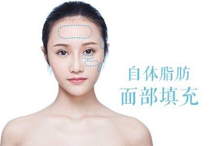 自体脂肪填充泪沟只能管5年?是因为你没这么做