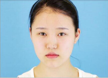 上海做下颌角好的医生有哪些