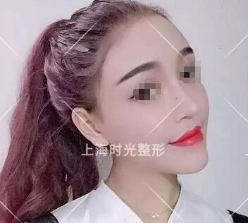 上海何晋龙磨骨好吗