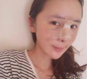 上海九院李青峰隆鼻技术怎么样?附门诊预约时间表
